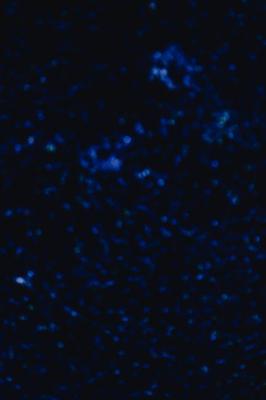 水瓶座天蝎座是最可怕的一对星座